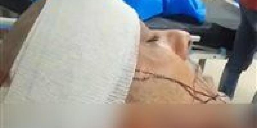 محاولة
      سرقة
      تنتهي
      بجريمة
      طعن..
      إصابة
      شاب
      بـ21
      غرزة
      والمتهم
      ما
      زال
      هاربًا
      ويُهدد
      المجني
      عليه - شوف 360 الإخباري