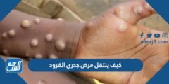كيف ينتقل مرض جدري القرود