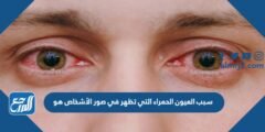 سبب العيون الحمراء التي تظهر في صور الأشخاص هو