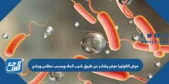 مرض الكوليرا مرض ينتشر عن طريق شرب الماء ويسبب عطاس ورشح