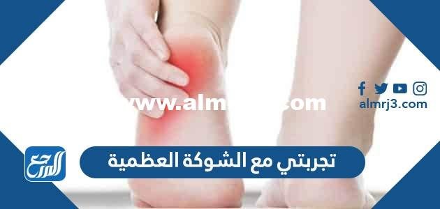 تجربتي مع الشوكة العظمية