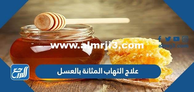 علاج التهاب المثانة بالعسل - موقع المرجع