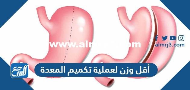 كم أقل وزن لعملية تكميم المعدة من تجاربكم