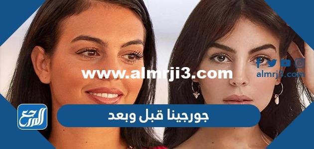 صور جورجينا قبل وبعد - موقع المرجع