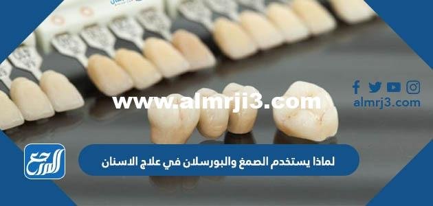 لماذا يستخدم الصمغ والبورسلان في علاج الاسنان