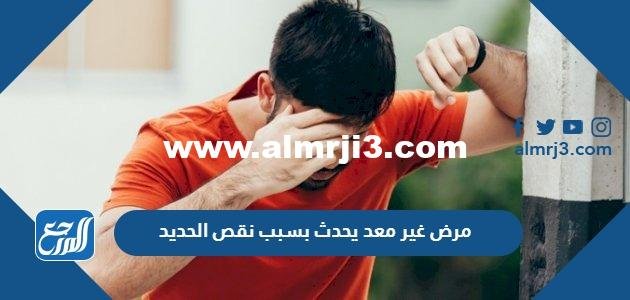 مرض غير معد يحدث بسبب نقص الحديد.