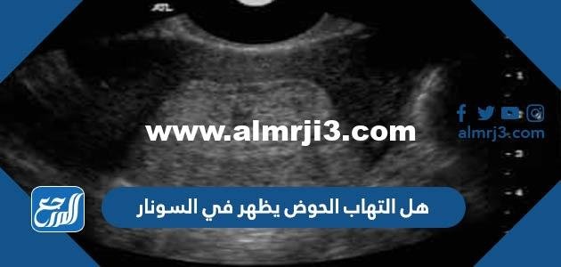 هل التهاب الحوض يظهر في السونار