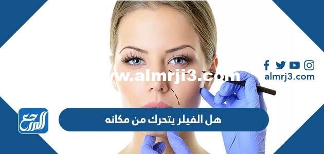 هل الفيلر يتحرك من مكانه بعد العملية