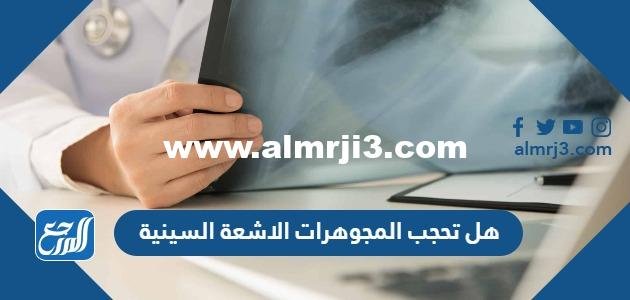 هل تحجب المجوهرات الاشعة السينية